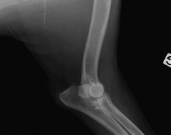 Radiographie d’un coude gauche d’un AS